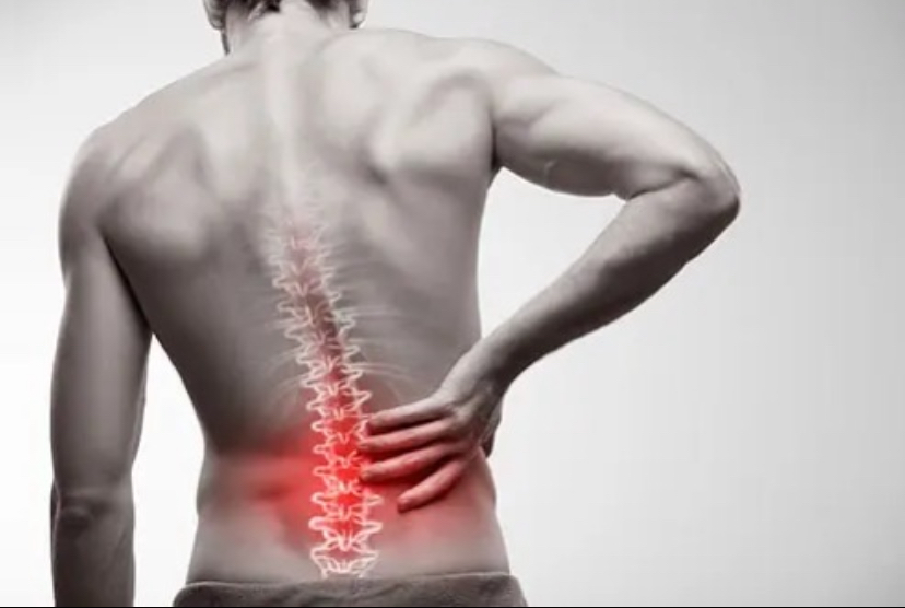 PSA: Fix your posture